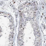 Atlas Antibodies Anti-ABCG4 Antibody
