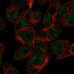 Atlas Antibodies Anti-ABCG5 Antibody