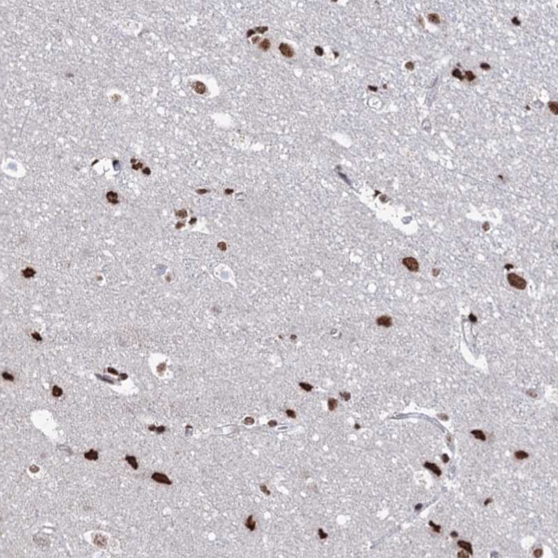 Atlas Antibodies Anti-ABHD10 Antibody
