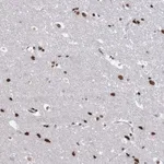 Atlas Antibodies Anti-ABHD10 Antibody