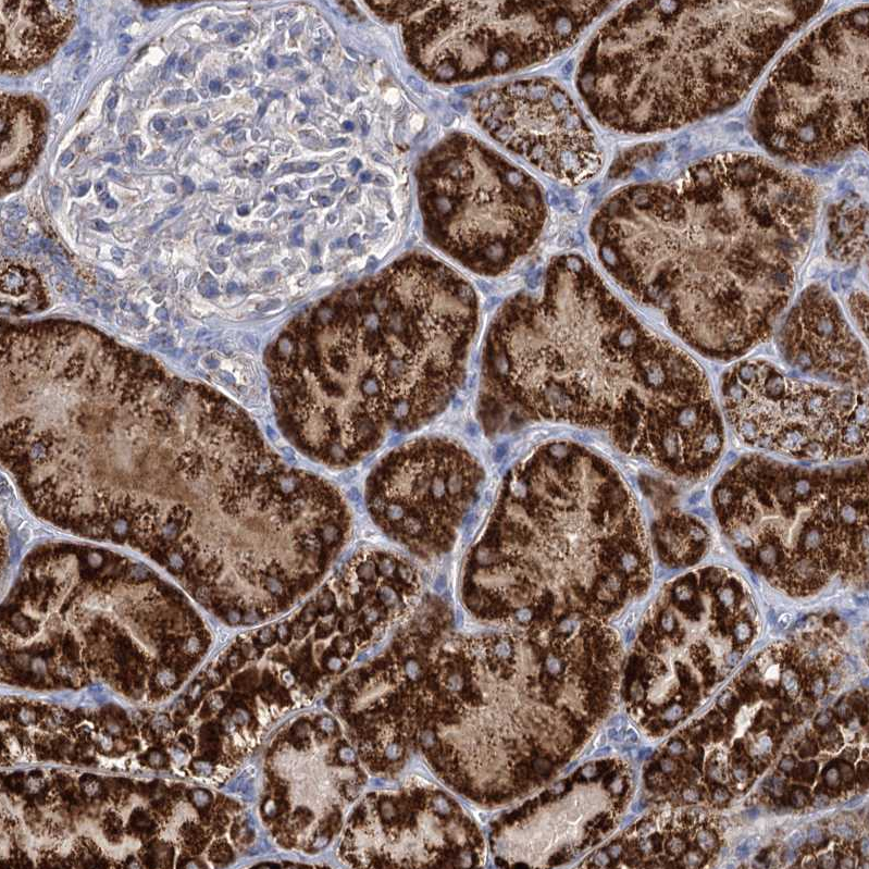 Atlas Antibodies Anti-ABHD10 Antibody