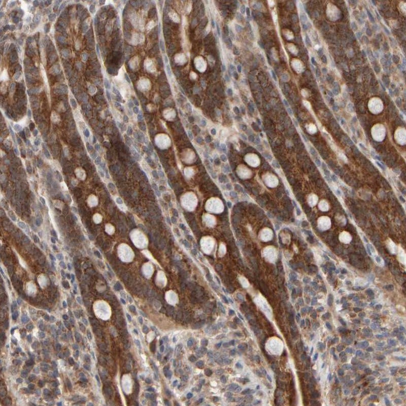 Atlas Antibodies Anti-ABHD11 Antibody