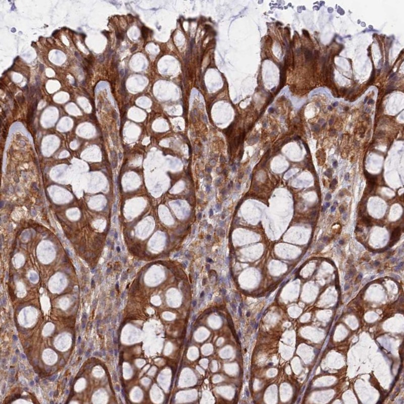 Atlas Antibodies Anti-ABHD1 Antibody