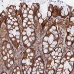 Atlas Antibodies Anti-ABHD1 Antibody