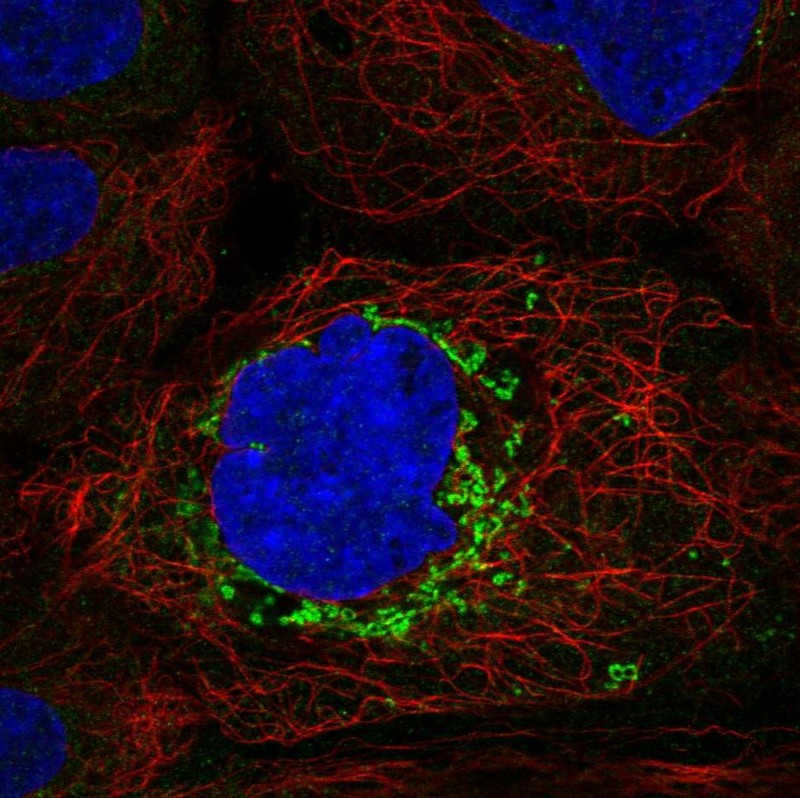 Atlas Antibodies Anti-ABHD10 Antibody