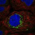 Atlas Antibodies Anti-ABHD10 Antibody