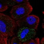Atlas Antibodies Anti-ABHD14A Antibody