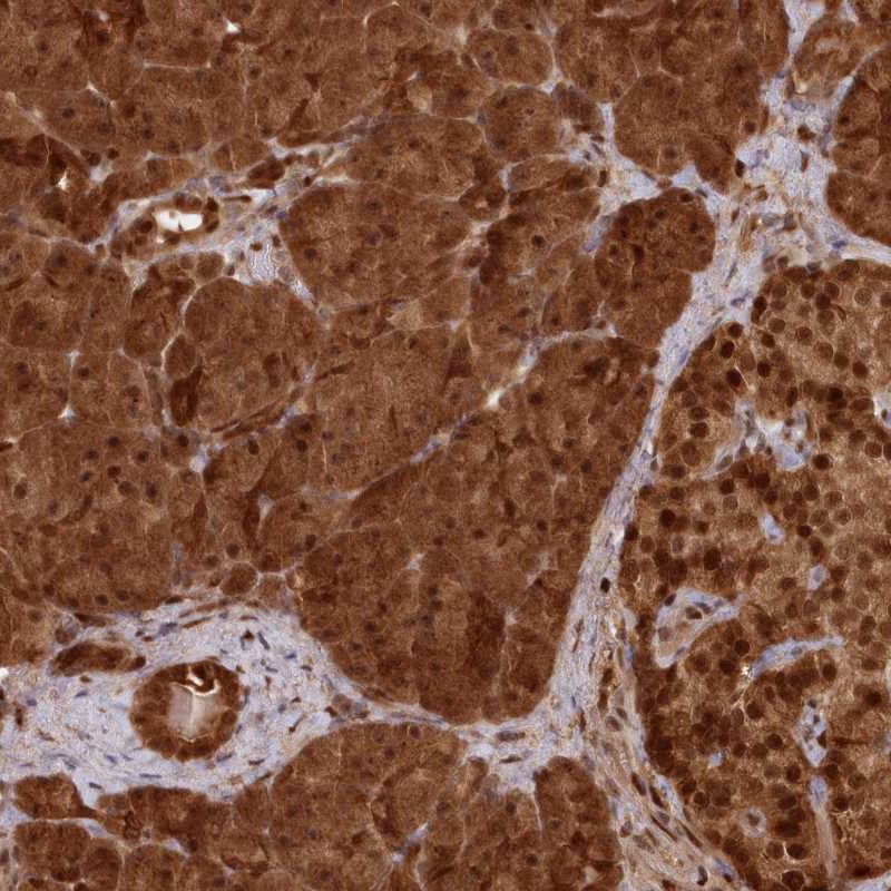 Atlas Antibodies Anti-ABHD14B Antibody