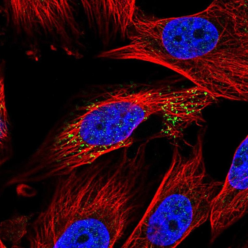 Atlas Antibodies Anti-ABHD14A Antibody
