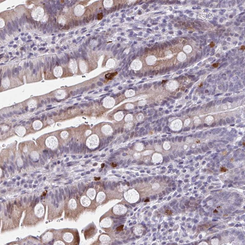 Atlas Antibodies Anti-ABHD16B Antibody
