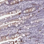 Atlas Antibodies Anti-ABHD16B Antibody