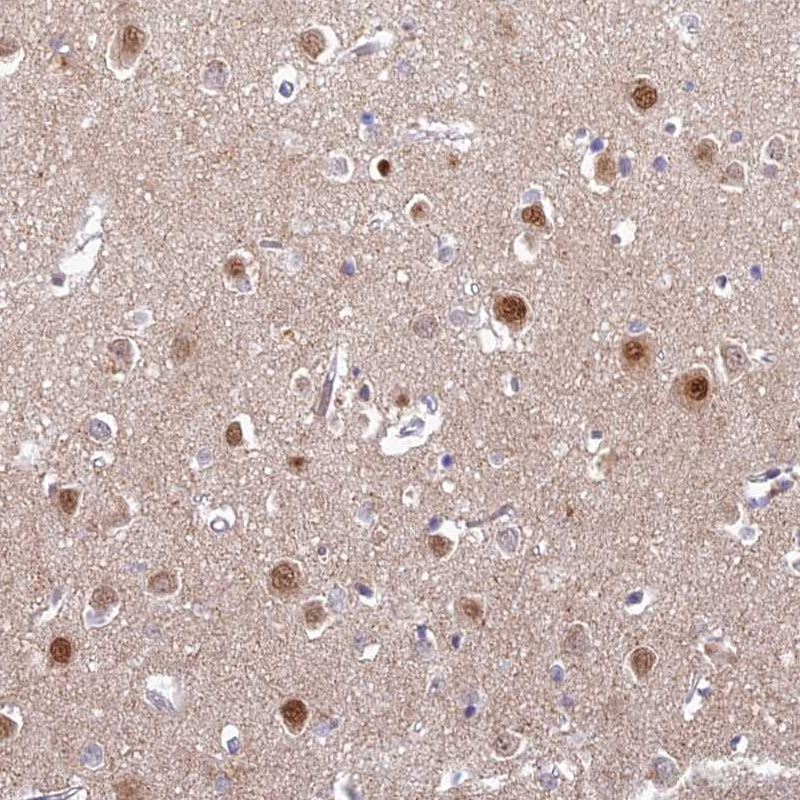 Atlas Antibodies Anti-ABHD17A Antibody