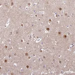 Atlas Antibodies Anti-ABHD17A Antibody