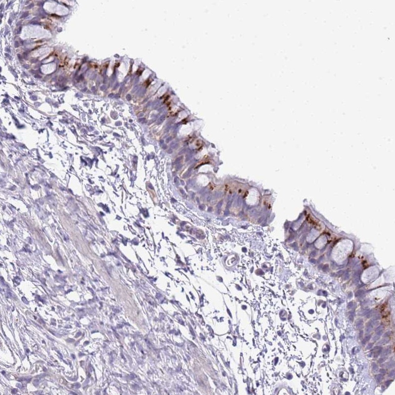 Atlas Antibodies Anti-ABHD17A Antibody