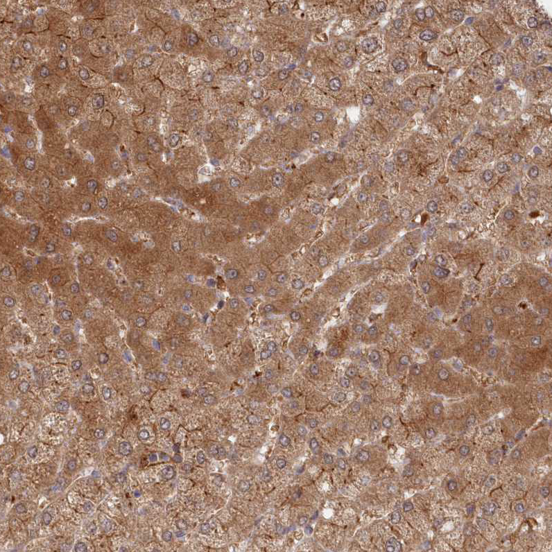 Atlas Antibodies Anti-ABHD14B Antibody