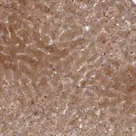 Atlas Antibodies Anti-ABHD14B Antibody