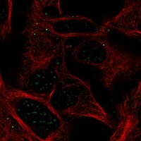 Atlas Antibodies Anti-ABHD17A Antibody