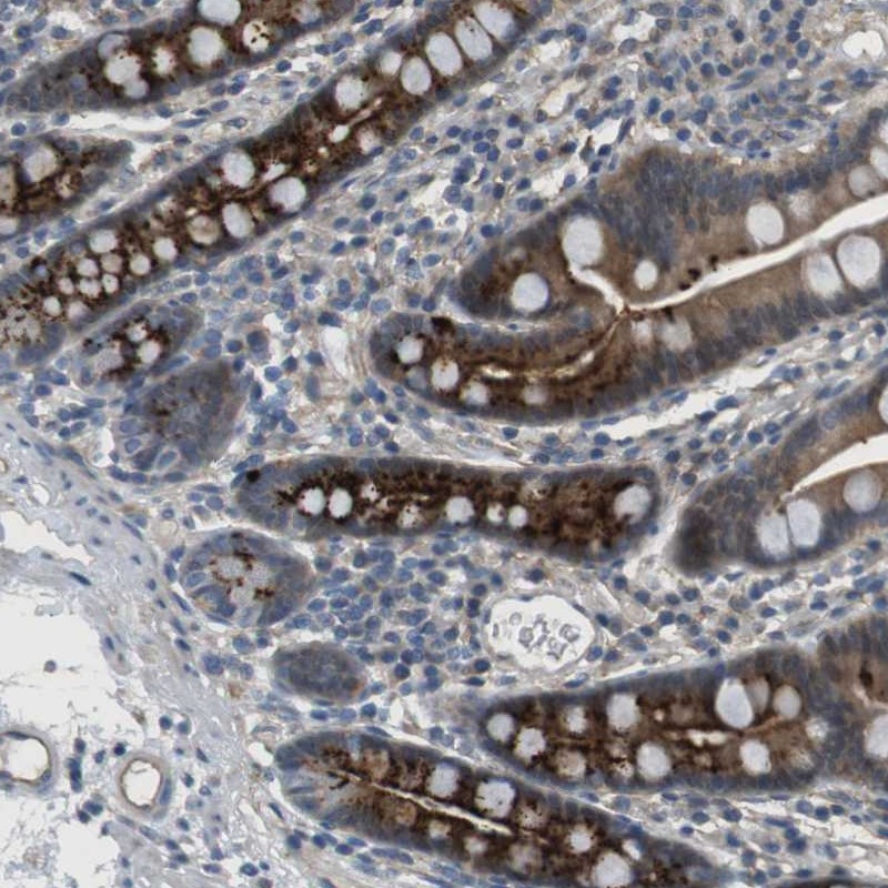 Atlas Antibodies Anti-ABHD15 Antibody