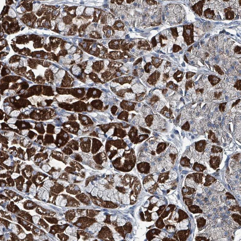 Atlas Antibodies Anti-ABHD18 Antibody