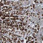Atlas Antibodies Anti-ABHD18 Antibody
