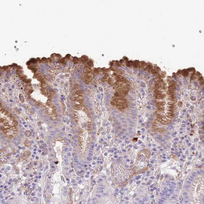 Atlas Antibodies Anti-ABHD17C Antibody