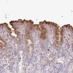 Atlas Antibodies Anti-ABHD17C Antibody