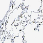 Atlas Antibodies Anti-ABHD3 Antibody