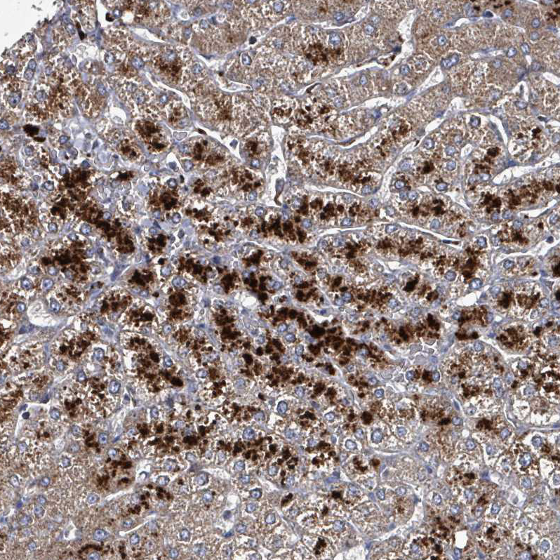 Atlas Antibodies Anti-ABHD18 Antibody
