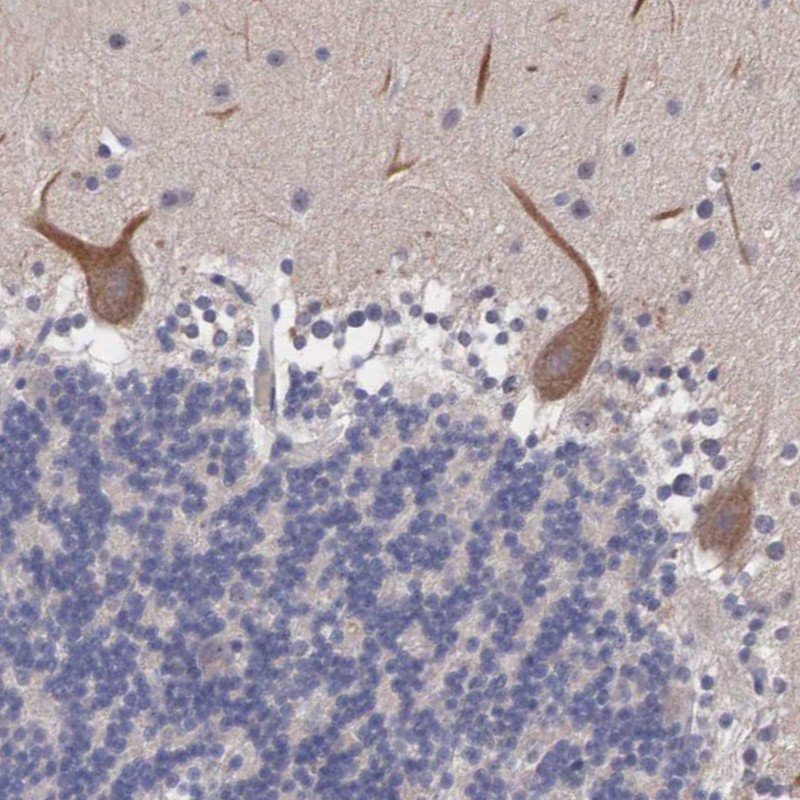 Atlas Antibodies Anti-ABHD4 Antibody