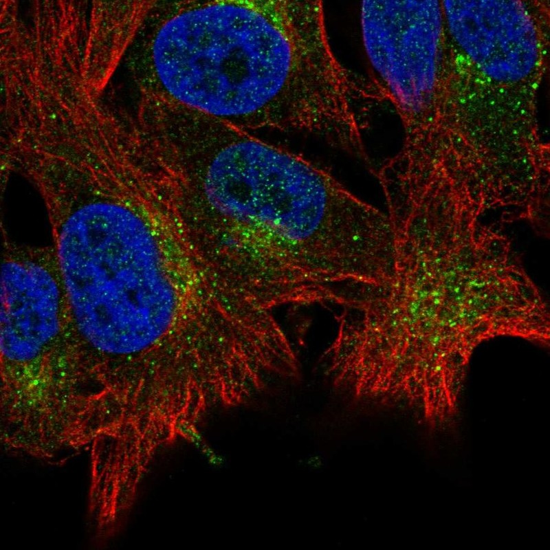 Atlas Antibodies Anti-ABHD6 Antibody