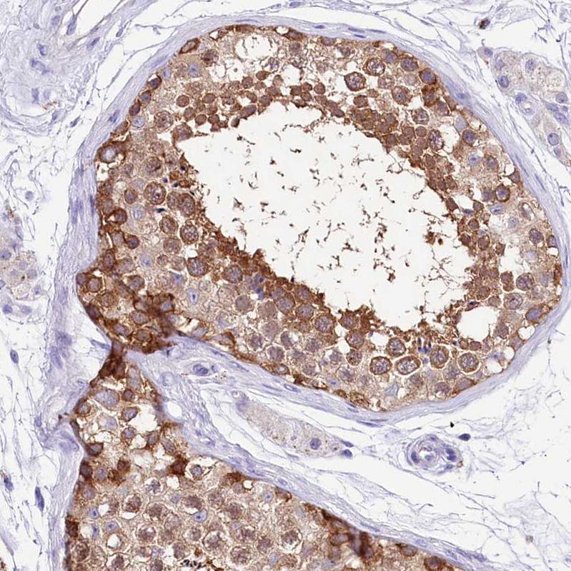 Atlas Antibodies Anti-ABHD5 Antibody