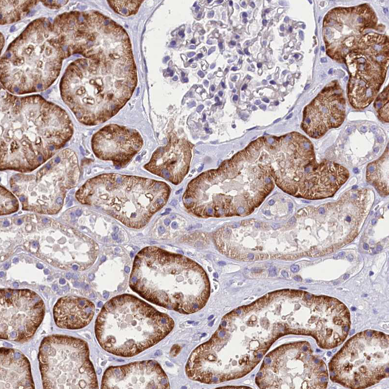 Atlas Antibodies Anti-ABHD5 Antibody