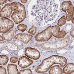 Atlas Antibodies Anti-ABHD5 Antibody