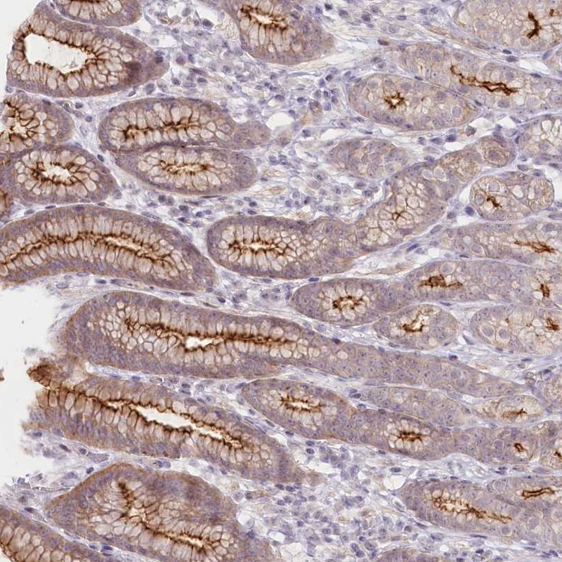 Atlas Antibodies Anti-ABHD8 Antibody