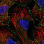 Atlas Antibodies Anti-ABI1 Antibody