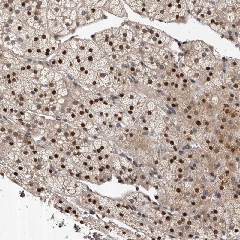 Atlas Antibodies Anti-ABL1 Antibody