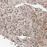 Atlas Antibodies Anti-ABL1 Antibody
