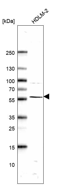 Atlas Antibodies Anti-ABI1 Antibody