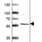 Atlas Antibodies Anti-ABI1 Antibody