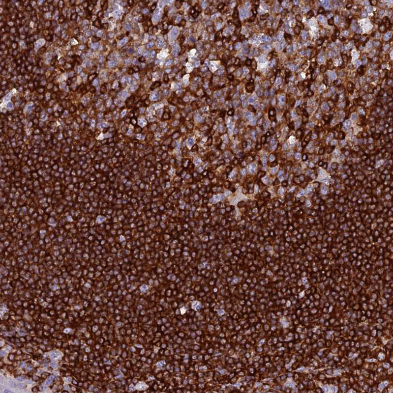 Atlas Antibodies Anti-ABI3BP Antibody