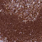 Atlas Antibodies Anti-ABI3BP Antibody