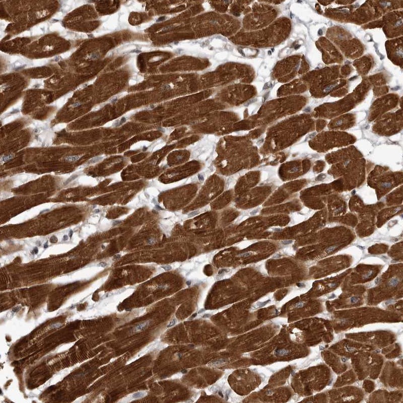 Atlas Antibodies Anti-ABL1 Antibody