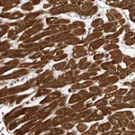 Atlas Antibodies Anti-ABL1 Antibody