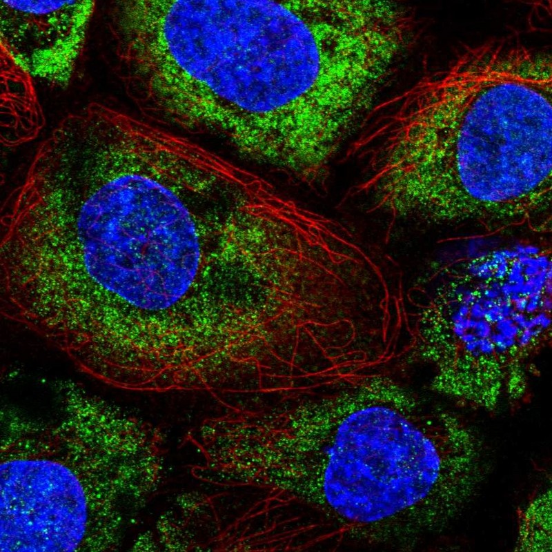 Atlas Antibodies Anti-ABR Antibody