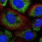 Atlas Antibodies Anti-ABR Antibody