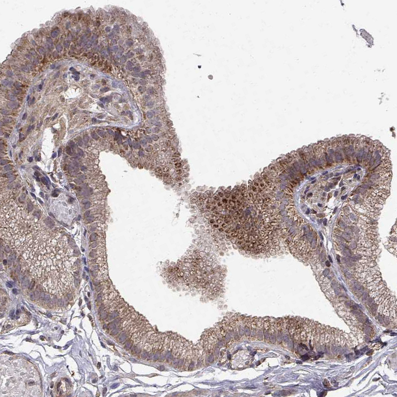 Atlas Antibodies Anti-ABL2 Antibody