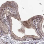 Atlas Antibodies Anti-ABL2 Antibody