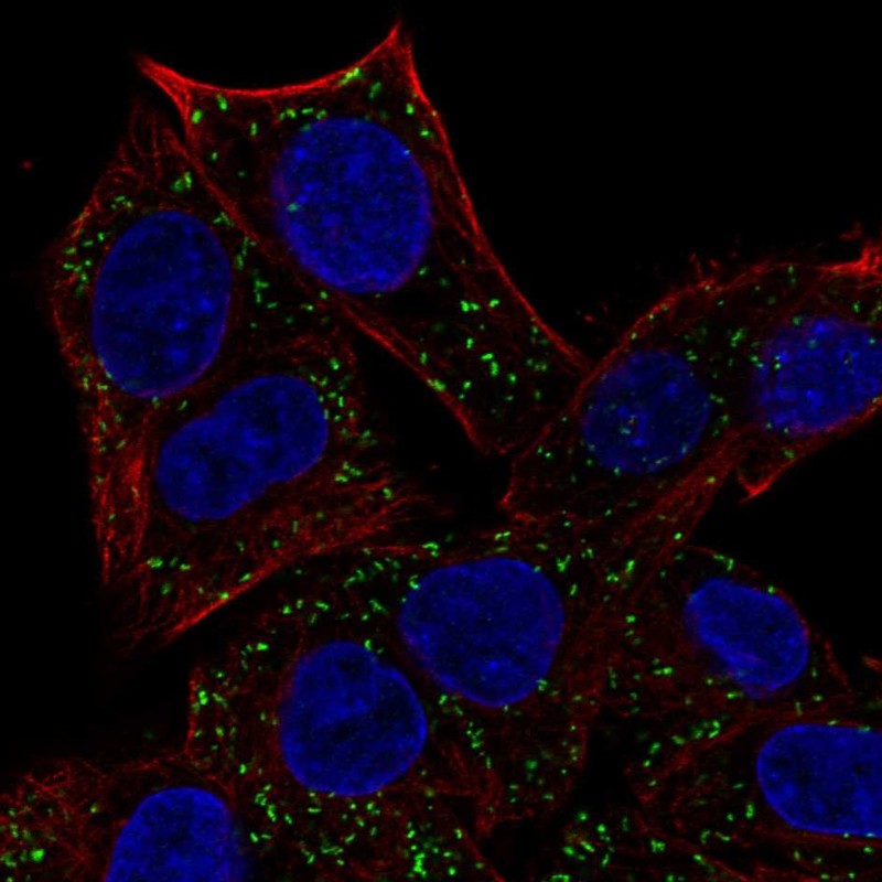 Atlas Antibodies Anti-ABT1 Antibody