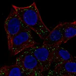 Atlas Antibodies Anti-ABT1 Antibody