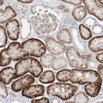 Atlas Antibodies Anti-ABLIM2 Antibody